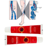 Varicosity Angiitis Remedy Removal Herbal Cream
