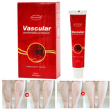 Varicosity Angiitis Remedy Removal Herbal Cream