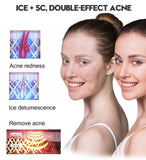 2020 Osenyuan 4in1 Icecool IPL Laser Hair Removal Permanent For Face Body Leg Bikini Electric Depiladora Laser Epilator