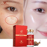 High quality snail100% essence hyaluronic acid liquid whitening spot essence shrink pores ampoule anti-acne regenerative essence