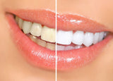ssss  Teeth Whitening Pen White Tooth Cleaning Bleaching Dental Professional Kit Teeth Whitening Gel Pen