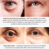 dasda  VIBRANT GLAMOUR Anti-wrinkle Eye Serum Hyaluronic Acid Remover Dark Circles Eye Cream Crocodile Against Puffiness Essence 20g